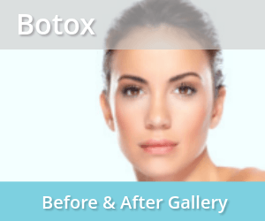 Botox-before-and-after-image-gallery-laser-skin-care-center