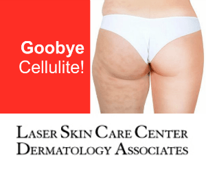 Will-cellfina-work-on-the-front-of-the-legs-long-beach-south-la-ca-laser-skin-care-center