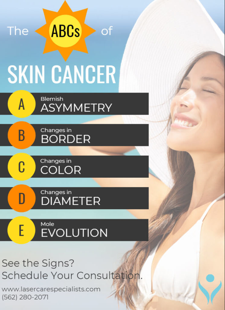 Skin Cancerinfographic Long Beach