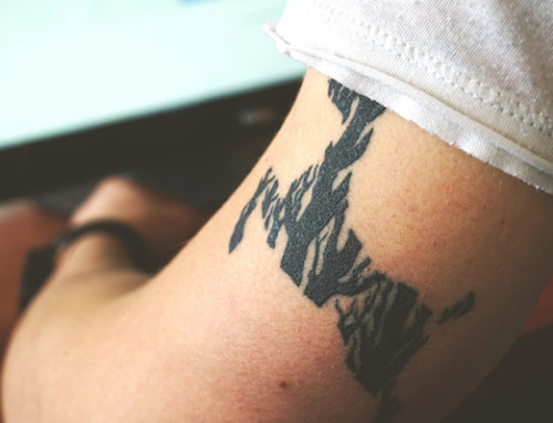 Can I Get Rid of My Tribal Tattoo?