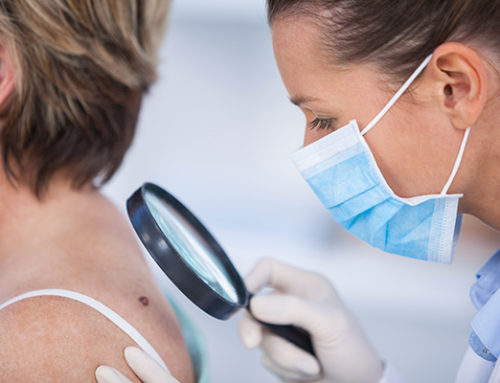 When Should I See My Doctor About A Mole?