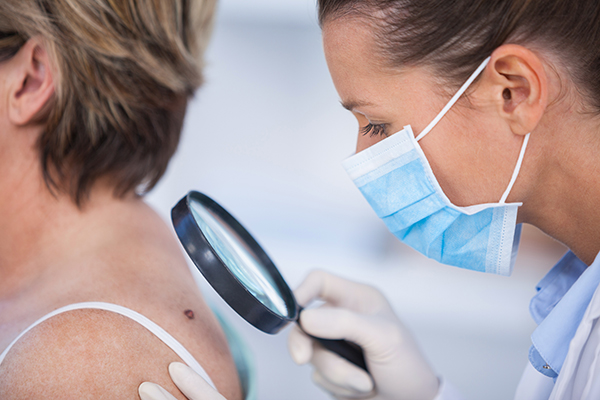 When Should I See a Doctor About a Mole? | Laser Skin Care Center