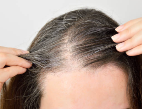 What’s The Best Way To Treat Thinning Hair?